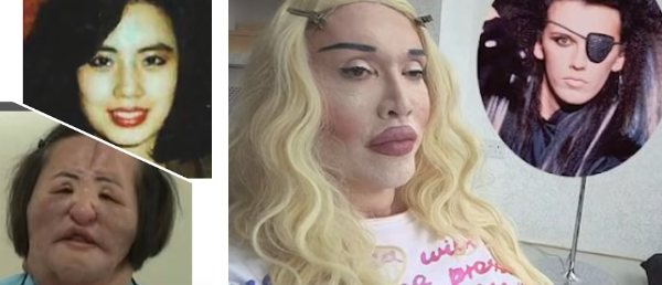 扇風機おばさん＆ピート・バーンズ