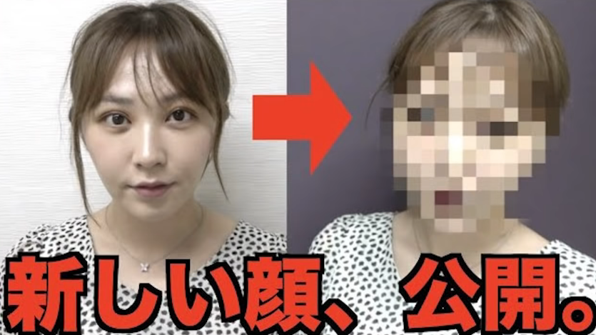 てんちむの整形