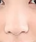 てんちむ鼻