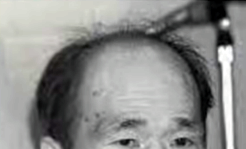 小野悦男髪の毛