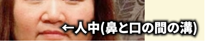 赤堀容疑者の人中・口元