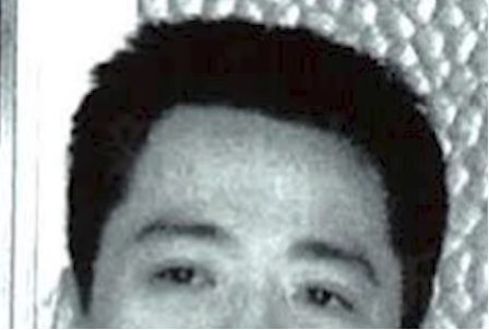 額周辺