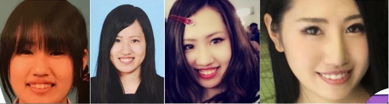 須田早貴の整形前と整形後