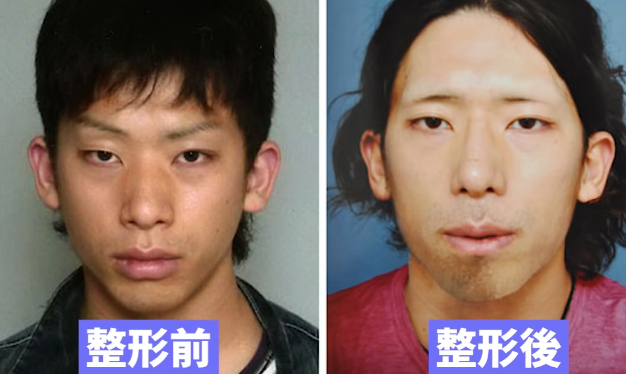 市橋達也の整形前と整形後の顔