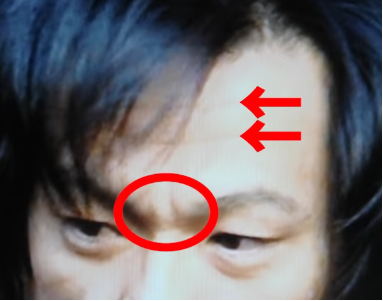 額の紋と目の間のしわ