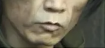 口