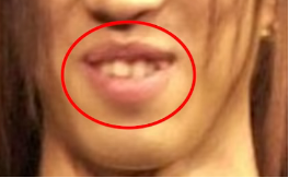 唇・歯