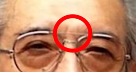 眉間