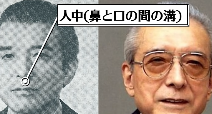 人中