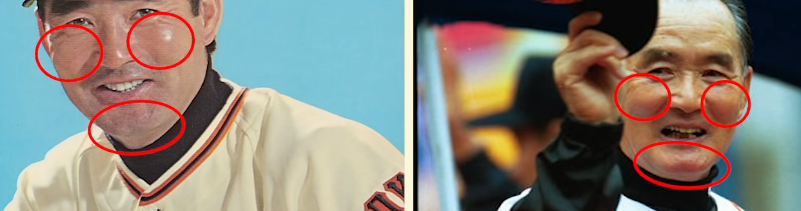 観骨やあごの占断