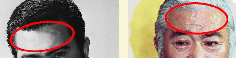 額・生え際