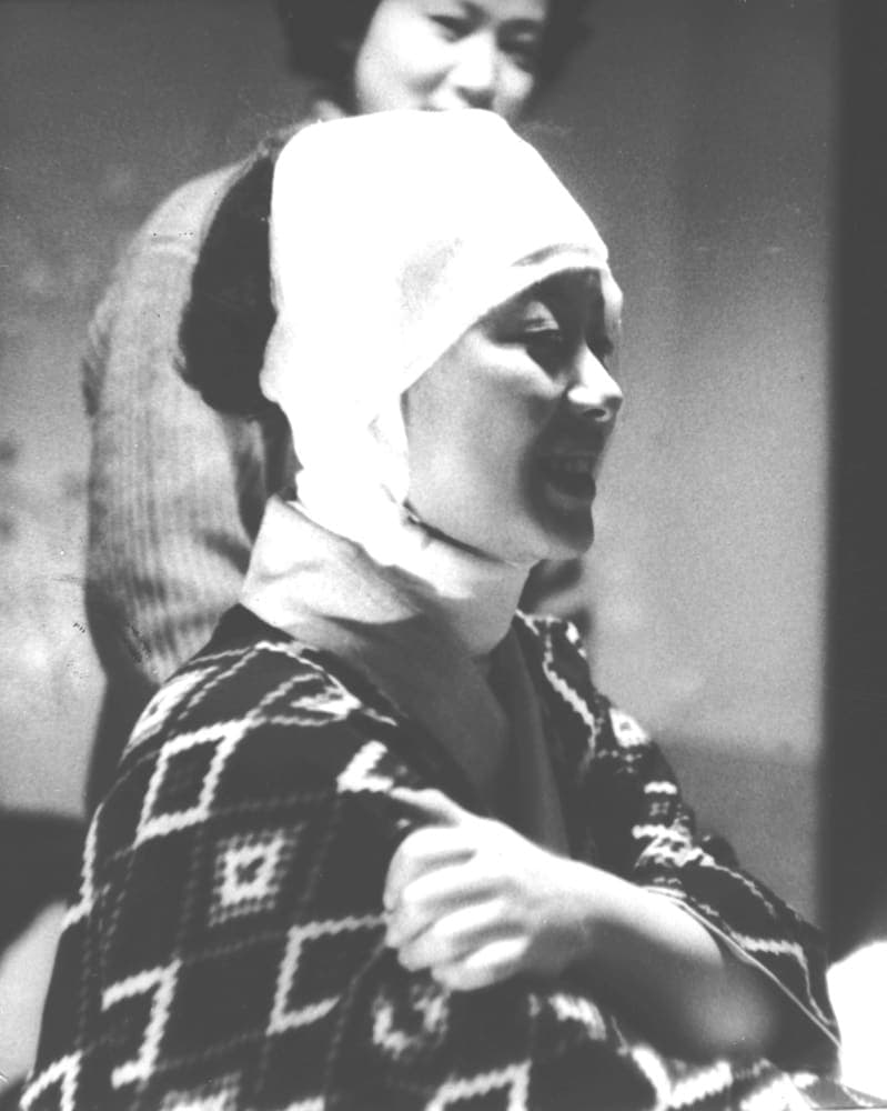 塩酸をかけられた美空ひばり